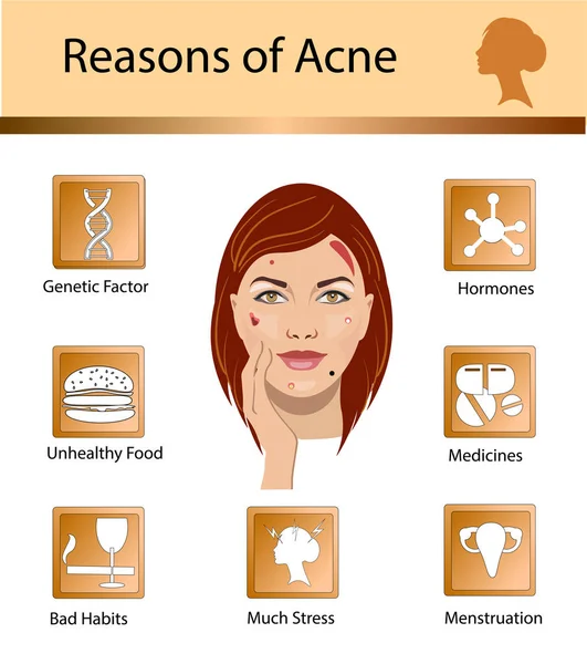 Acne skäl. Hud problem och sjukdomar skönhet infographics. Vektorillustration. — Stock vektor