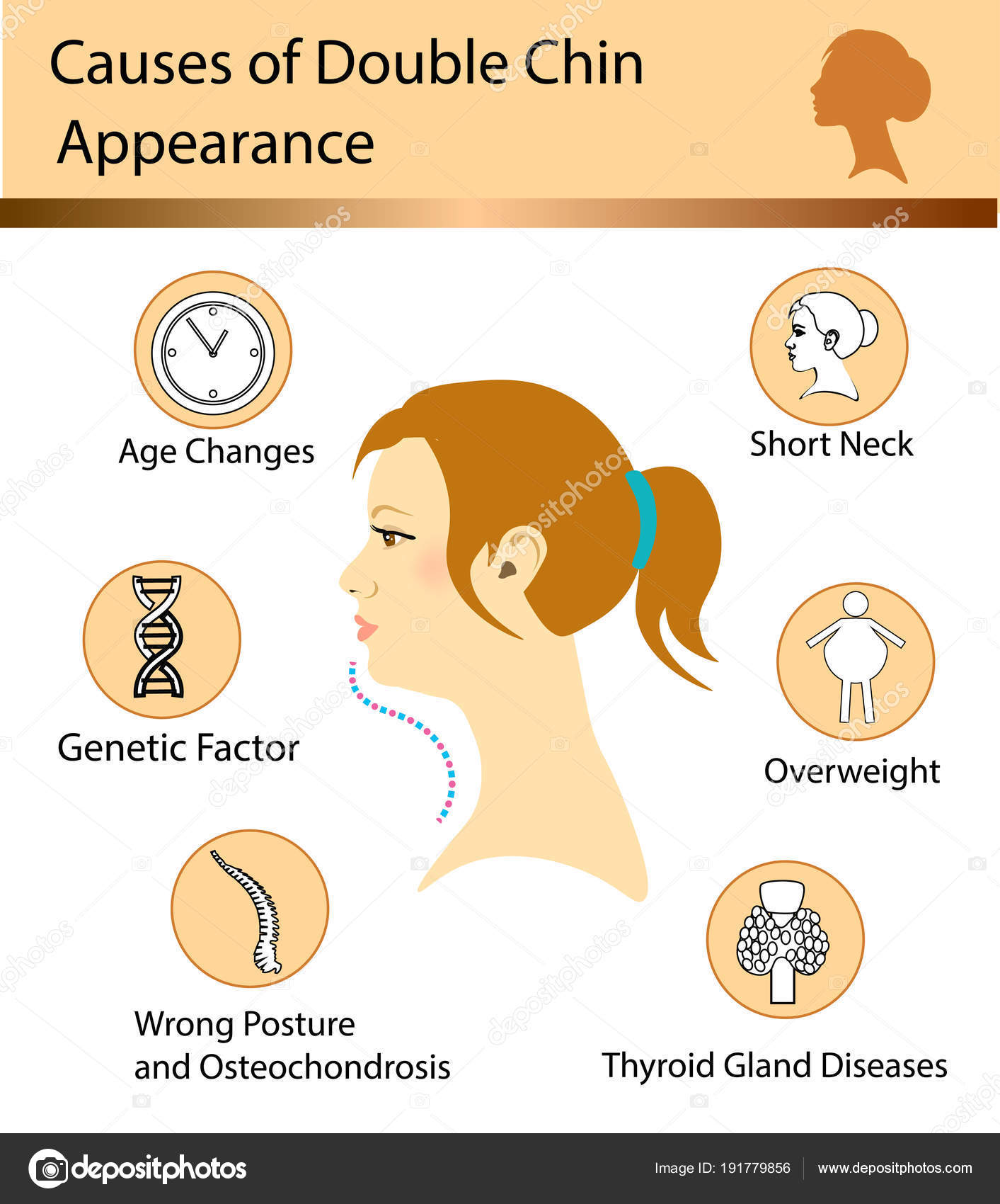 Causes Of Double Chin Stock Vector Image By bemoll 191779856 can-sugar-cause-acne-are-sugar-and-acne-correlated-tiege-hanley