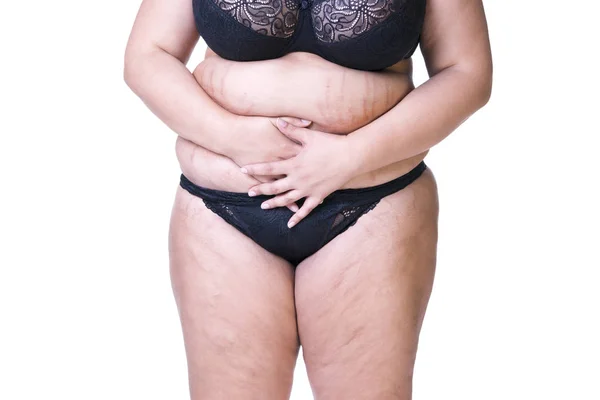 Жирный женский живот после беременности, растяжки крупным планом — стоковое фото