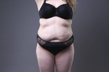Plus size model in black lingerie, overweight female body, fat woman with stretch marks on gray background clipart