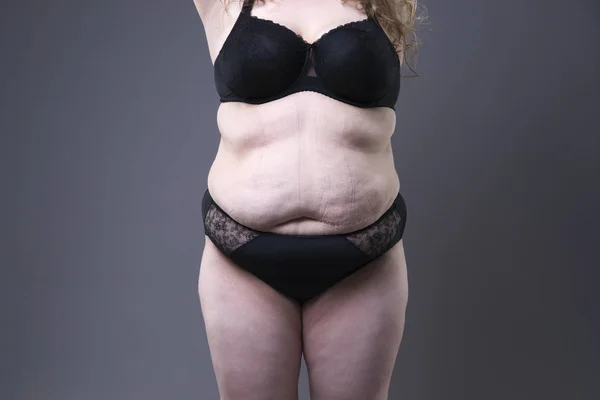 Modello Plus size in lingerie nera, corpo femminile sovrappeso, donna grassa con smagliature su sfondo grigio — Foto Stock