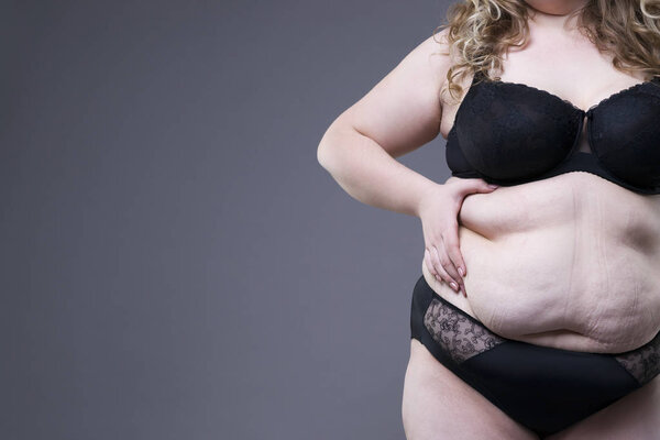 Plus size model in black lingerie, overweight female body, fat woman with stretch marks on gray background