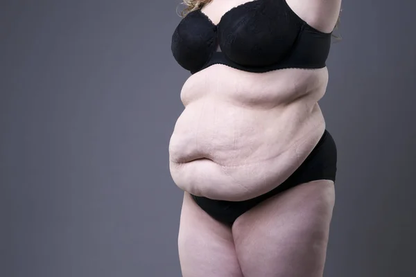 Modelo de talla grande en lencería negra, cuerpo femenino con sobrepeso, mujer gorda con estrías sobre fondo gris — Foto de Stock