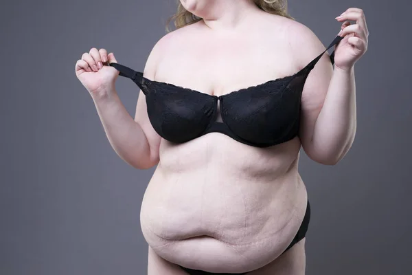 Plus Size Model in schwarzer Dessous, übergewichtiger weiblicher Körper, dicke Frau mit Dehnungsstreifen auf grauem Hintergrund — Stockfoto