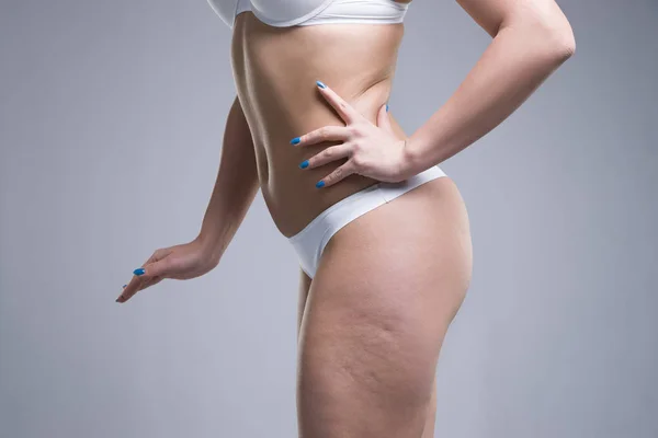 Frau in weißer Unterwäsche auf grauem Hintergrund, Cellulite auf weiblichem Körper — Stockfoto