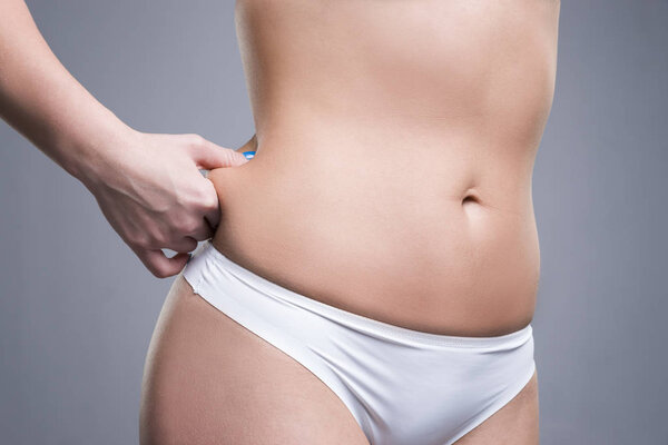 Woman holding fold of skin, cellulite on female body, gray background