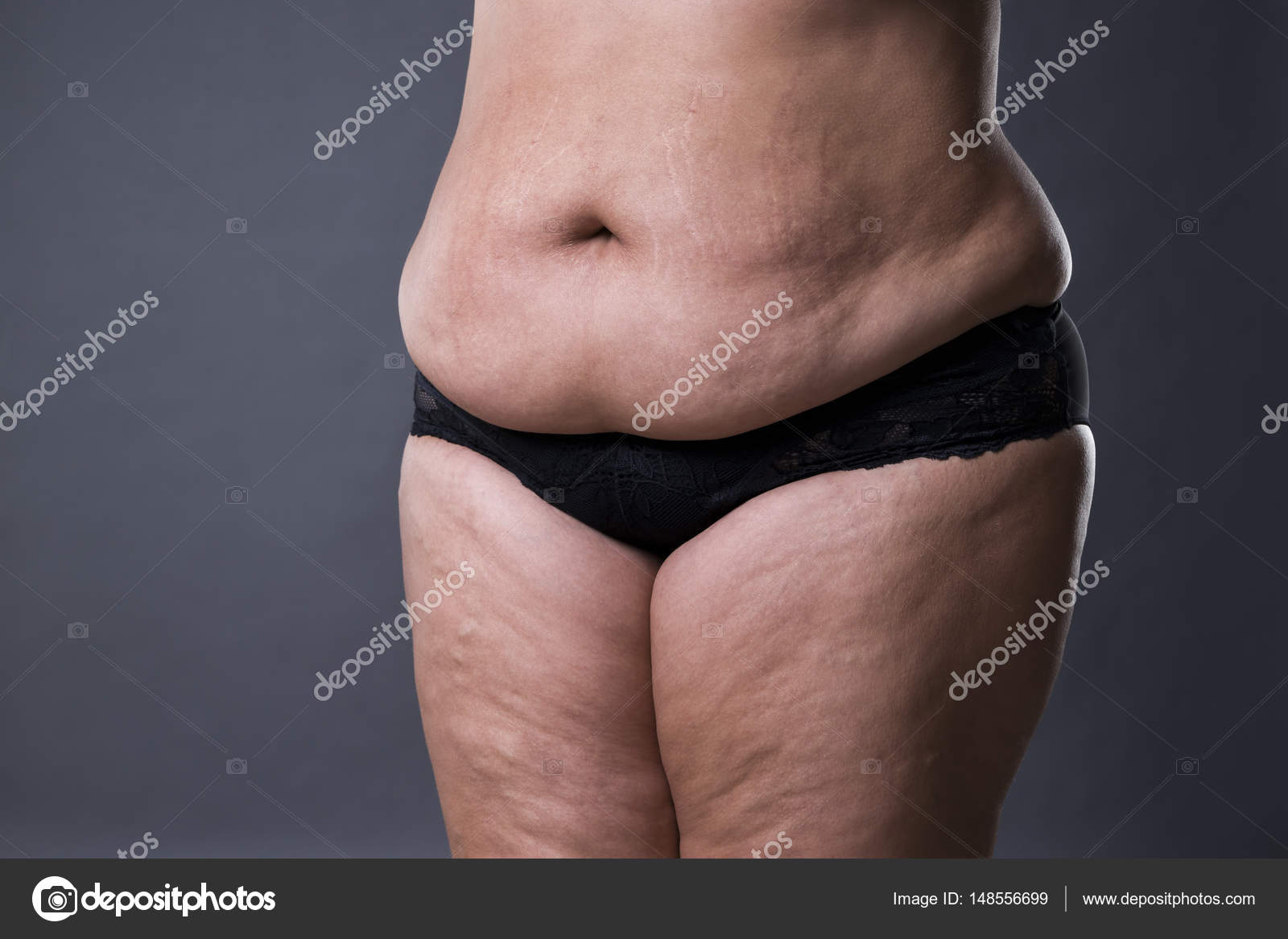 женский живот. джози гибсон целлюлит. жирок на животе женщины. живот женщины в возрасте. живот у женщин после 60.