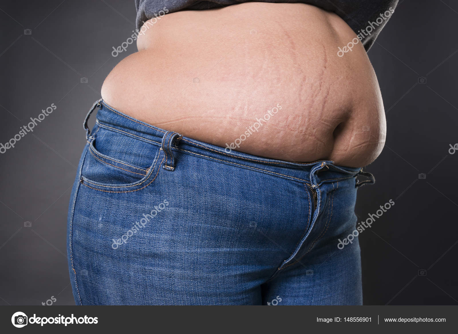 Woman Belly Fat Hanging Over Jeans Stock Photos - Free & Royalty-Free Stock  Photos from Dreamstime