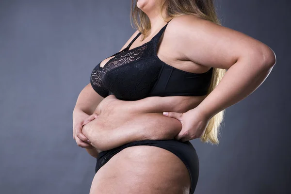 Mujer con abdomen gordo, estómago femenino con sobrepeso, estrías en el vientre de cerca — Foto de Stock