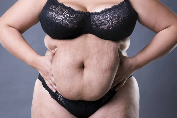 Женщина с толстой брюшной полостью, избыточный вес женского желудка, растяжки на животе крупным планом — стоковое фото