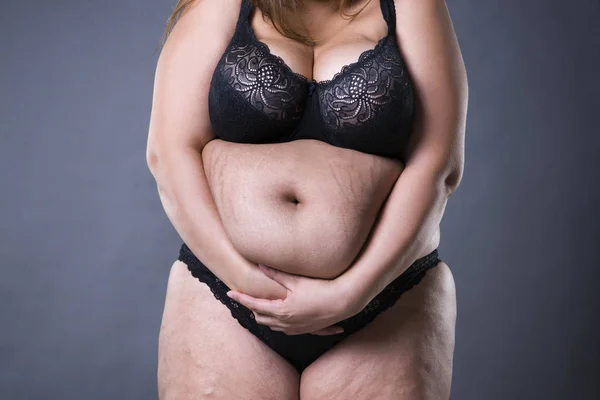 Woman with fat abdomen, overweight female stomach, stretch marks on belly closeup