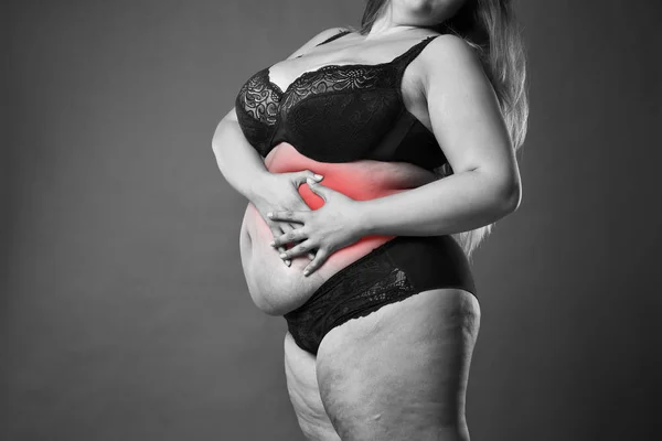 Fat woman with appendicitis attack, abdominal pain, stomach ache, overweight female body on gray background — Stock Photo, Image