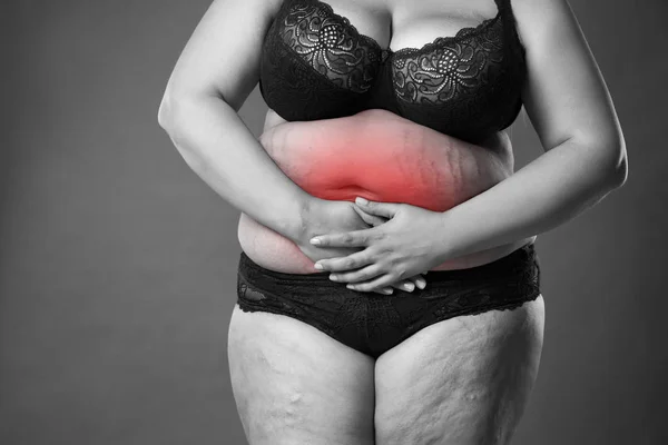 Donna grassa con dolore mestruale, endometriosi o cistite, mal di stomaco, corpo femminile sovrappeso su sfondo grigio — Foto Stock