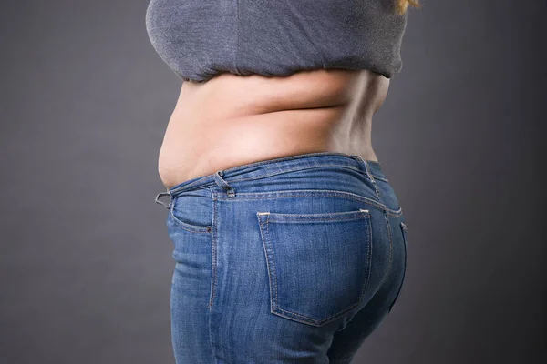 Mujer con abdomen gordo en jeans azules, estómago femenino con sobrepeso, estrías en el primer plano del vientre —  Fotos de Stock