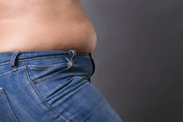 Wanita dengan perut gemuk dengan celana jeans biru, perut wanita yang kelebihan berat badan, tanda peregangan pada tutup perut — Stok Foto