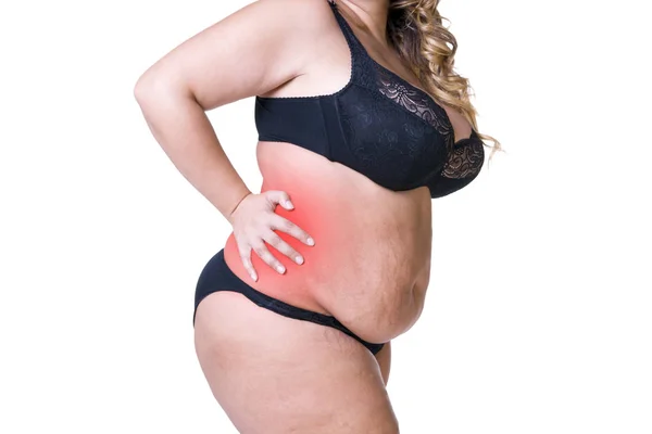 Dolor de espalda, mujer gorda con dolor de espalda, cuerpo femenino con sobrepeso aislado sobre fondo blanco — Foto de Stock