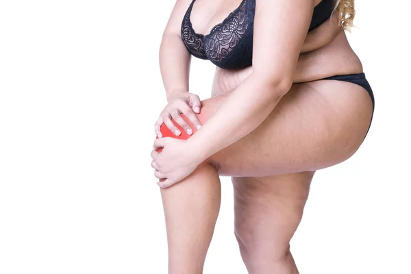 Dolor de rodilla, mujer gorda con artritis articular, cuerpo femenino con sobrepeso aislado sobre fondo blanco — Foto de Stock