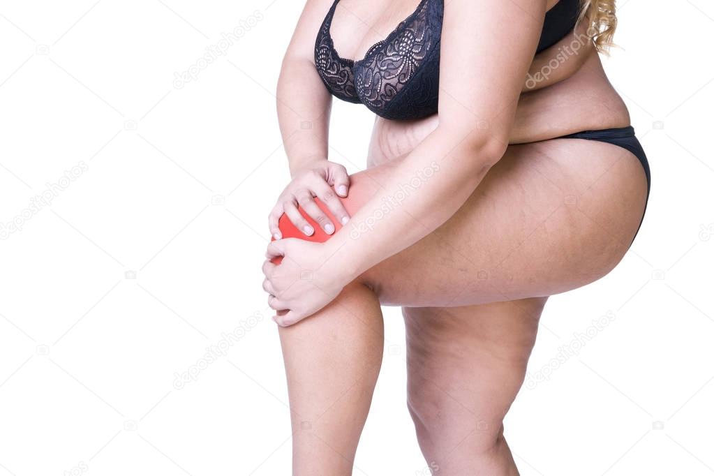 Knee pain, fat woman with joint arthritis, overweight female body isolated on white background