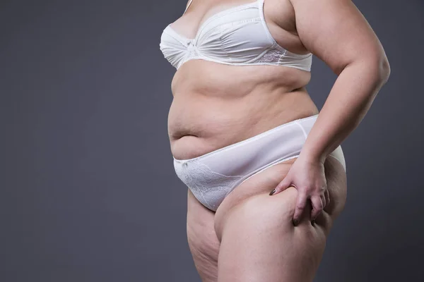Жінка з жировим черевом, надмірна вага жіночого живота — стокове фото