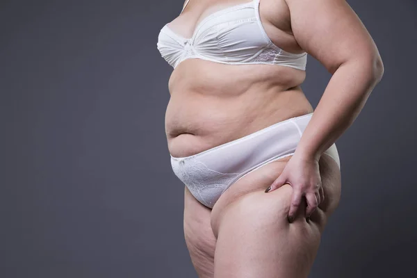 Mulher com abdômen gordo, estômago feminino com excesso de peso — Fotografia de Stock