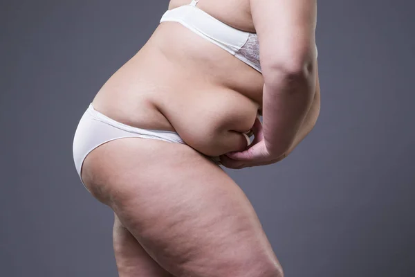 Overweight woman with fat abdomen, obesity female body