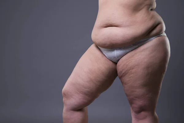 Mulher com abdômen gordo, estômago feminino com excesso de peso — Fotografia de Stock