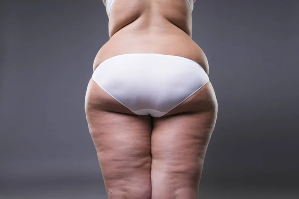 Femme en surpoids avec de grosses jambes et les fesses, l'obésité du corps féminin — Photo