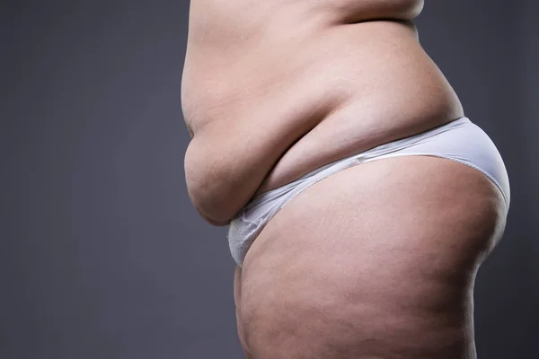 Mujer con abdomen gordo, estómago femenino con sobrepeso —  Fotos de Stock