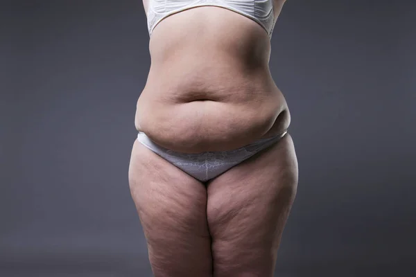 Mujer con abdomen gordo, estómago femenino con sobrepeso — Foto de Stock