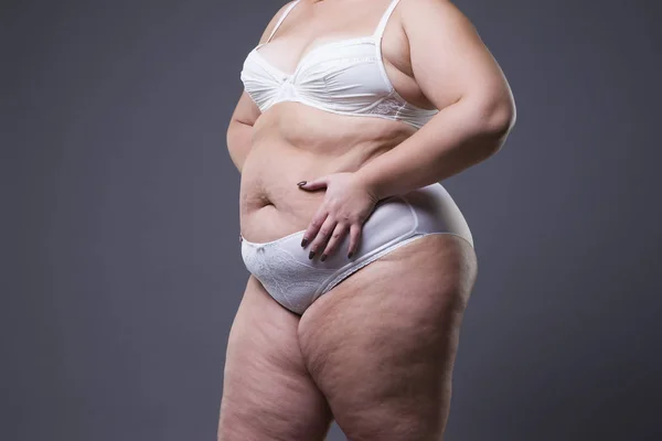 Mujer con abdomen gordo, estómago femenino con sobrepeso —  Fotos de Stock