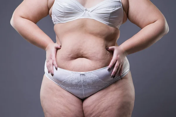 Mujer con abdomen gordo, estómago femenino con sobrepeso — Foto de Stock