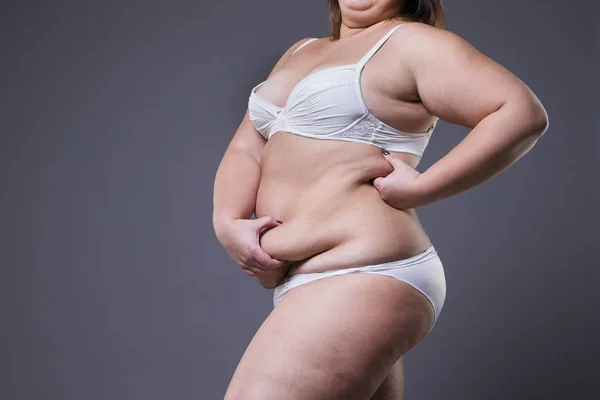 Mujer con abdomen gordo, estómago femenino con sobrepeso —  Fotos de Stock