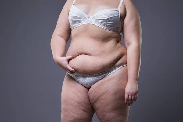 Mujer con abdomen gordo, estómago femenino con sobrepeso — Foto de Stock