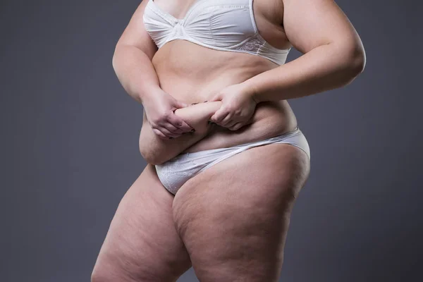 Woman with fat abdomen, overweight female stomach — Stock Photo, Image