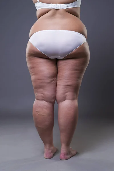 Übergewichtige Frau mit dicken Beinen und Gesäß, Fettleibigkeit weiblichen Körper — Stockfoto