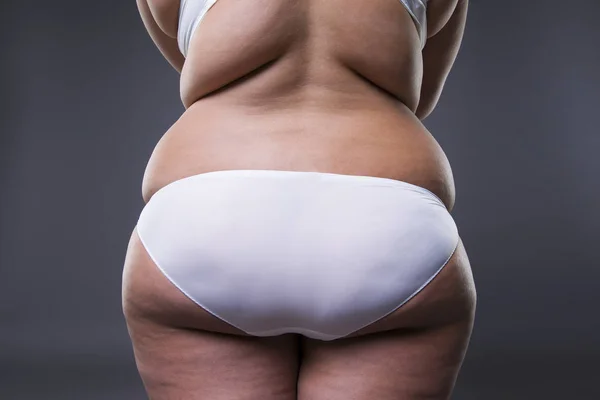Mujer con sobrepeso, piernas gordas y nalgas, obesidad cuerpo femenino —  Fotos de Stock