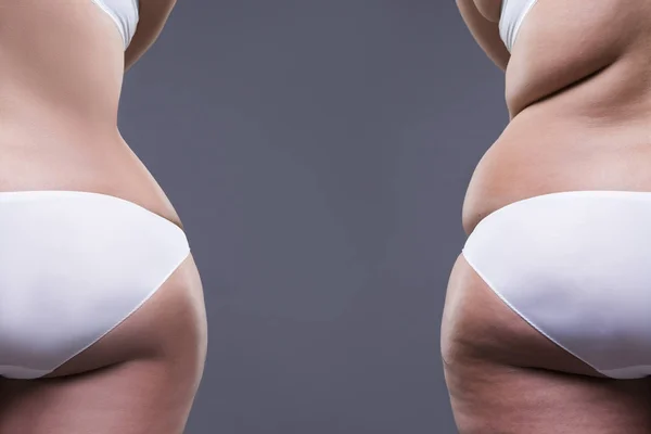 Överviktig kvinna med fett ben och skinkor, innan efter konceptet, fetma kvinnokroppen, bakifrån — Stockfoto