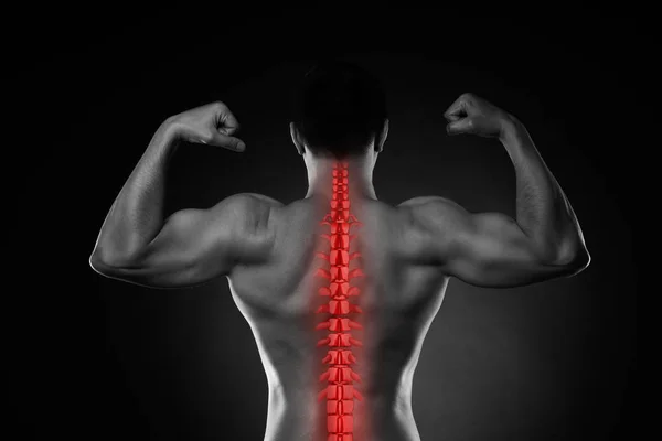 Pain in the spine, a man with backache, injury in the human back — Stock Photo, Image