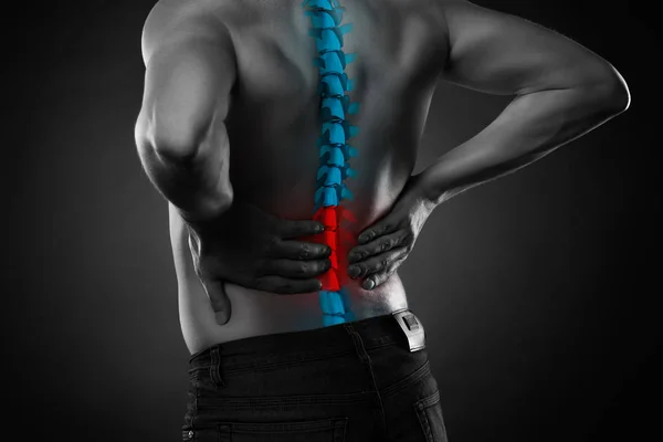 Dolore alla colonna vertebrale, un uomo con mal di schiena, lesioni nella parte bassa della schiena — Foto Stock