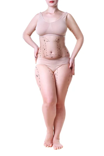 Fettsugning, fett och celluliter avlägsnande koncept, överviktiga kvinnokroppen med målade linjer och pilar — Stockfoto