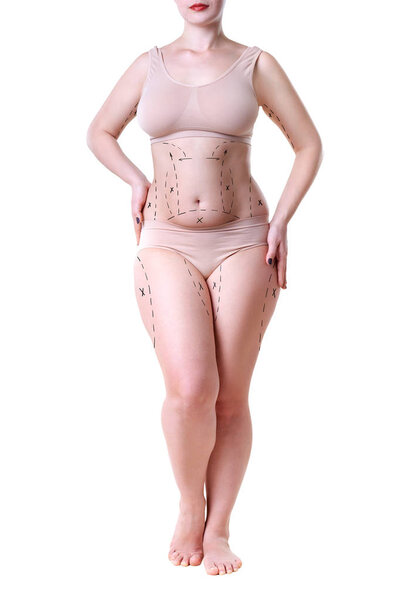 Liposuction, fat and cellulite removal concept, overweight female body with painted lines and arrows