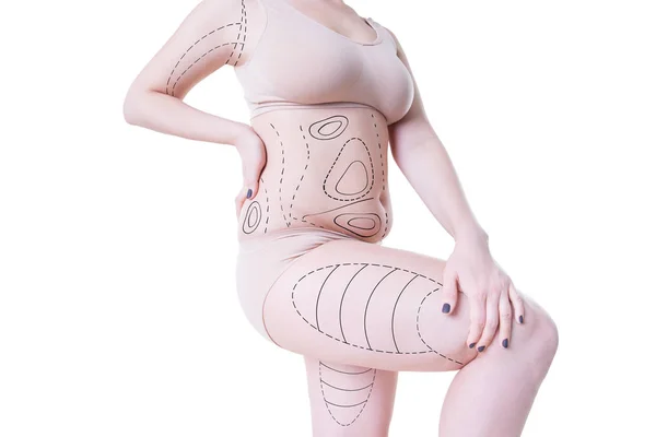 Liposuction, fat and cellulite removal concept, overweight female body with painted lines and arrows — Stock Photo, Image