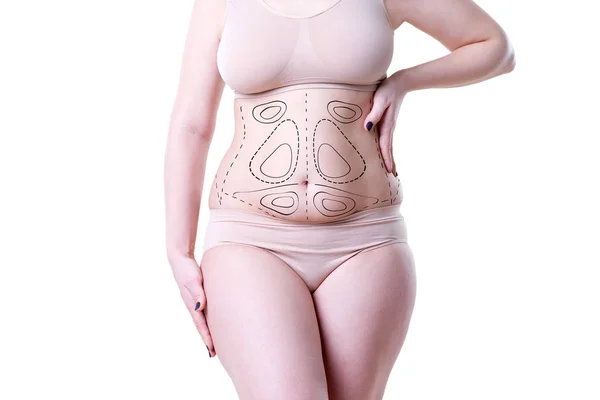 Liposucción, concepto de eliminación de grasa y celulitis, cuerpo femenino con sobrepeso con líneas y flechas pintadas — Foto de Stock