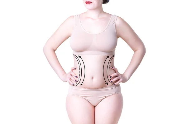 Liposuction, fat and cellulite removal concept, overweight female body with painted lines and arrows — Stock Photo, Image