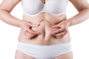 Tummy Tuck, yağlı göbek üzerinde gevşek cilt, plastik cerrahi kavramı