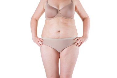 Tummy Tuck, yağlı göbek üzerinde gevşek cilt, plastik cerrahi kavramı