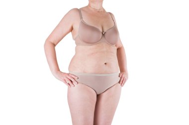 Tummy tuck, flabby skin on a fat belly, plastic surgery concept clipart