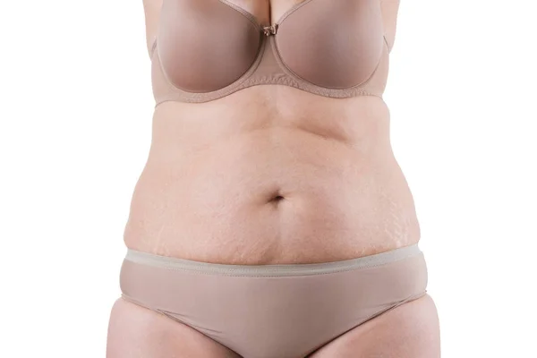 Tummy tuck, peau flasque sur un ventre gras, concept de chirurgie plastique — Photo