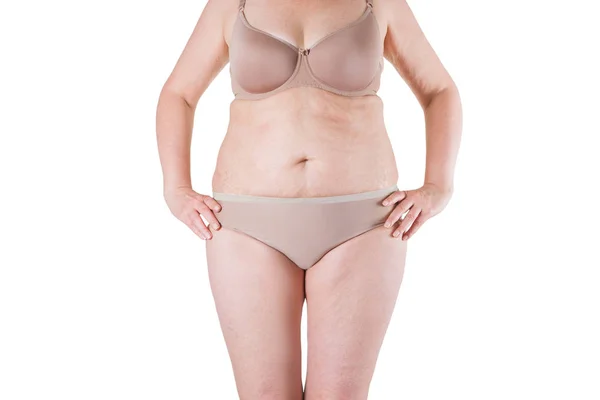 Tummy Tuck, slappe huid op een dikke buik, plastische chirurgie concept — Stockfoto