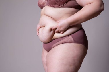 Tummy Tuck, yağlı göbek üzerinde gevşek cilt, plastik cerrahi kavramı